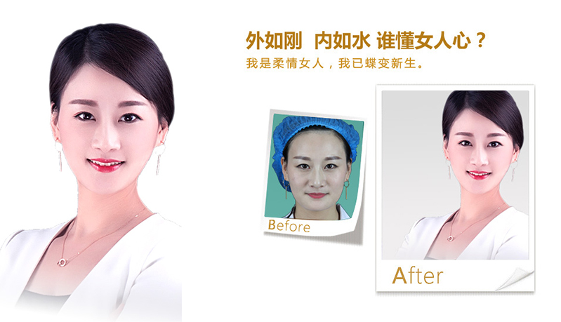 合川V脸、线雕隆鼻